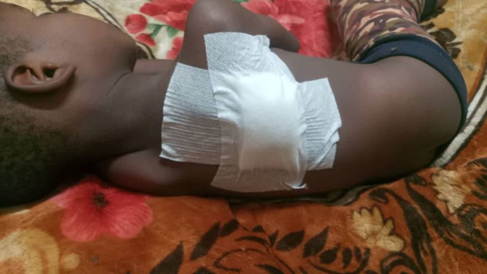 Abéché: Un enfant est victime d&rsquo;une balle perdue.